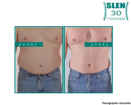 Slen 30 x2 - Gel minceur - Maitighar