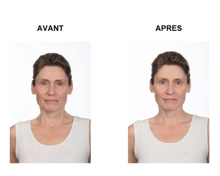 Tense express plus x2 - Tenseur gel express - Maitighar