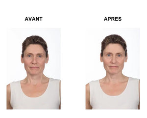 Tense express plus x2 - Tenseur gel express - Maitighar