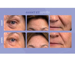 Charger l&#39;image dans la galerie, Cure derma miracle 3 mois - Cure collagene - Maitighar
