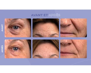 Cure derma miracle 3 mois - Cure collagene - Maitighar