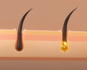Root active x2 - Soin capillaire - Maitighar