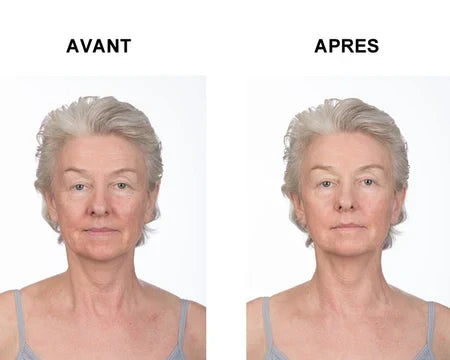 Tense express plus x2 - Tenseur gel express - Maitighar