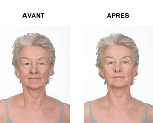 Tense express plus x2 - Tenseur gel express - Maitighar
